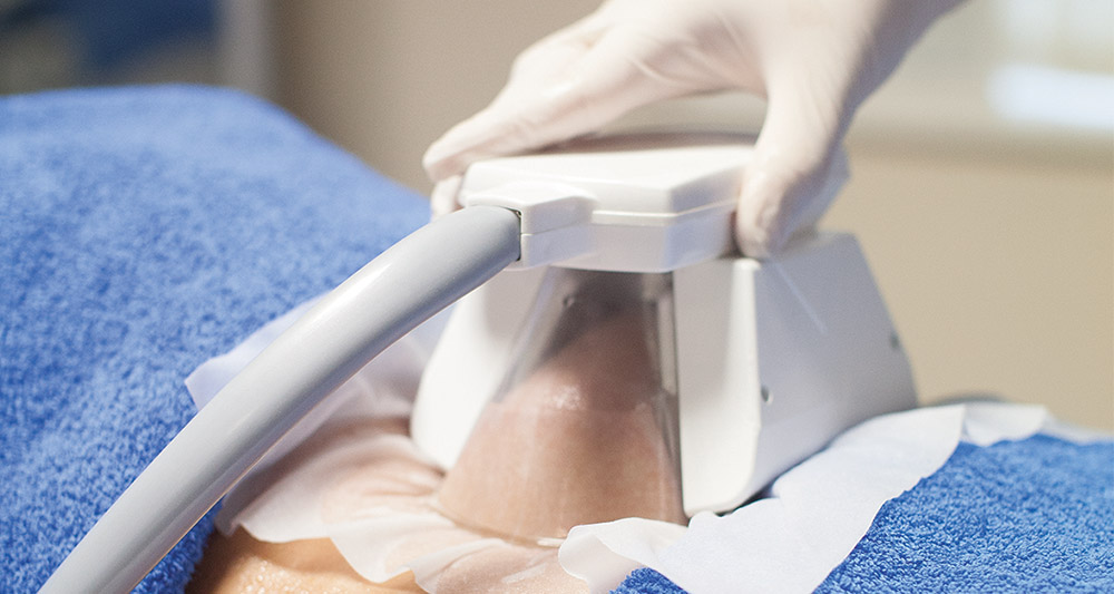 How Fat Freezing and HIFU Work Together? 2 Multiple Areas in One Session HIFU and Fat Freezing Windlesham