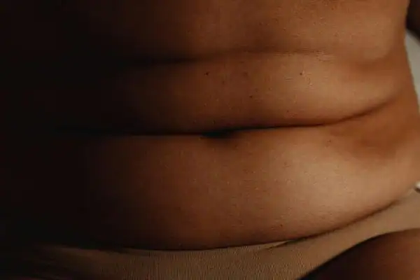 The Hidden Connection: How Stress Shapes Your Fitness and Body Composition 3 image of what stress can do on the stomach area and how Lipo 360 Windlesham can help to change your body shape.