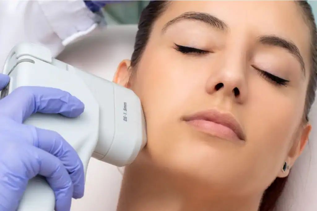 Discover the Perfect Duo: RF Microneedling and HIFU 2 Image of Morpheus8 And HIFU Combined with Lipo 360 Windlesham